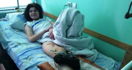 Донецким врачам удалось сохранить ногу ополченки Юлии Касенковой