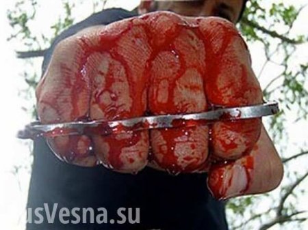 Пострадал за Украину: в Кривом Роге жестоко избили «атошника»