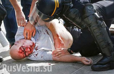 «Умерший» после драки с русскими британский фанат открыл глаза
