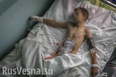 Condition of child, wounded in Donetsk shelling remains grave